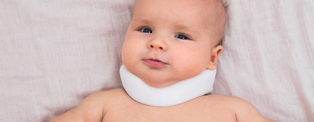 Torticollis-hoito imeväisillä varhain monien komplikaatioiden estämiseksi