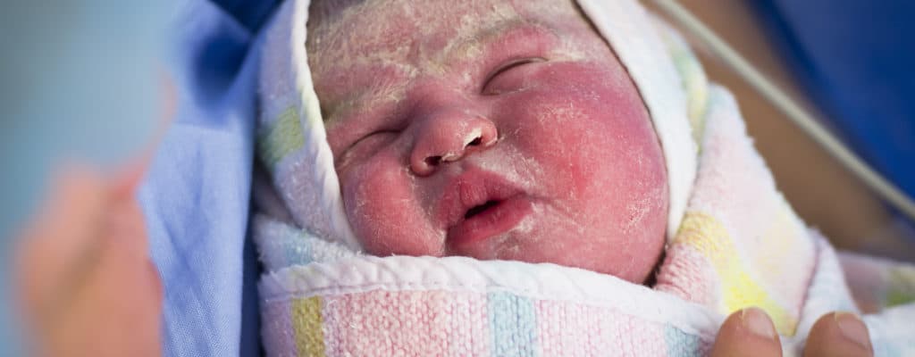 Co víte o bílé voskové vrstvě na těle miminka?