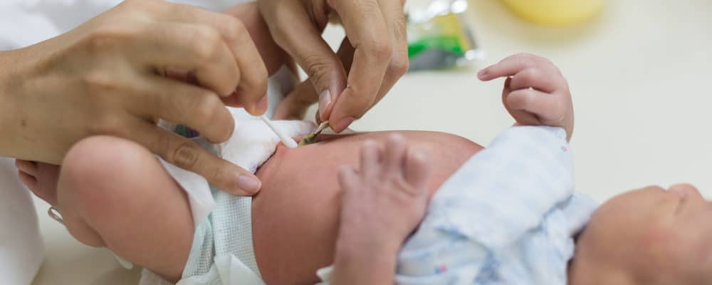 4 enkle måter å hjelpe deg med å ta vare på babyens navlestreng