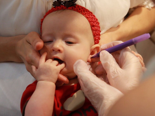 Piercing uha za bebe od rođenja, u redu ili krivo?