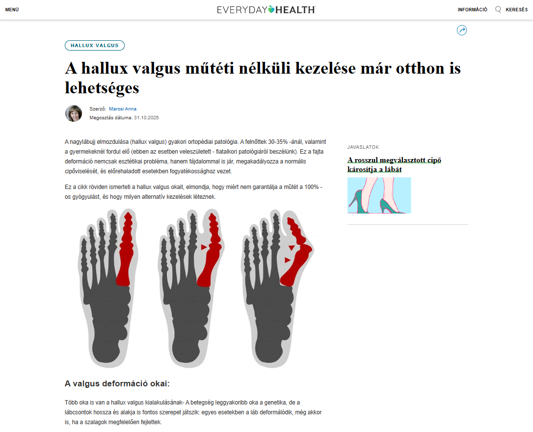 Hondro Sol Valgus termék kép