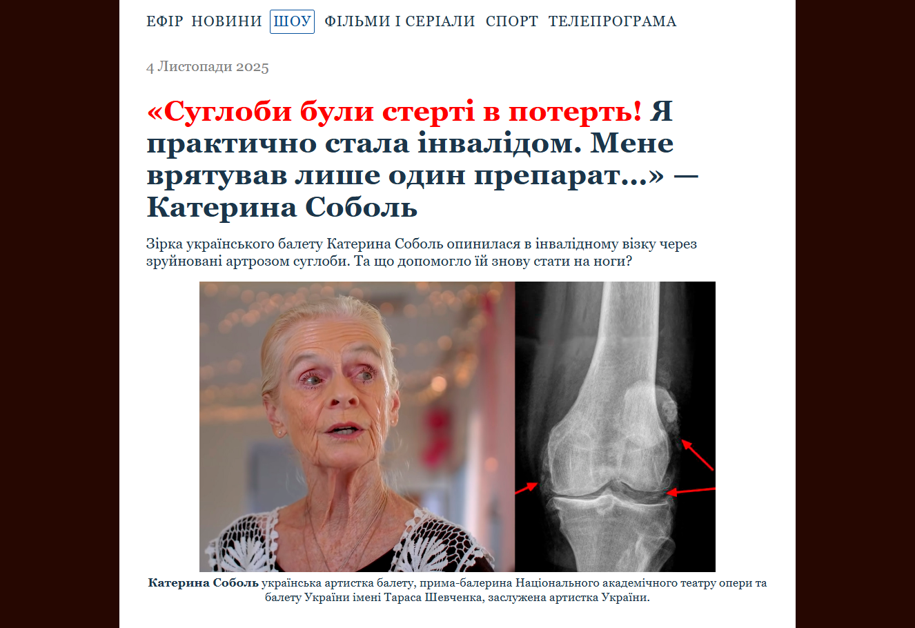 Зображення ArthroLead для здоров'я суглобів